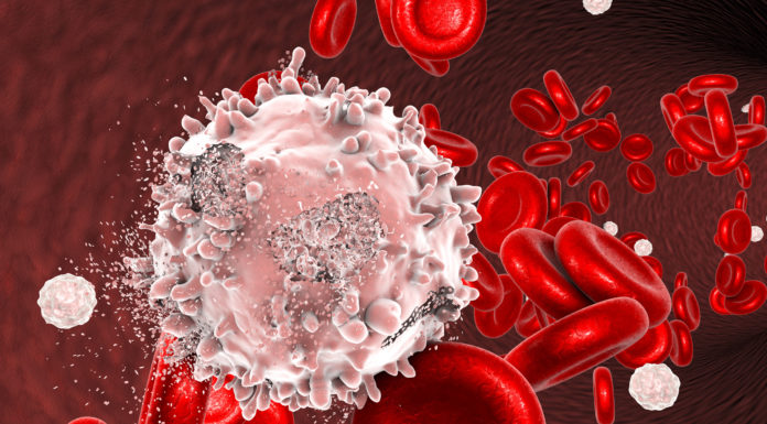 La UE aprueba Calquence de AstraZeneca para el tratamiento de la leucemia linfocítica crónica