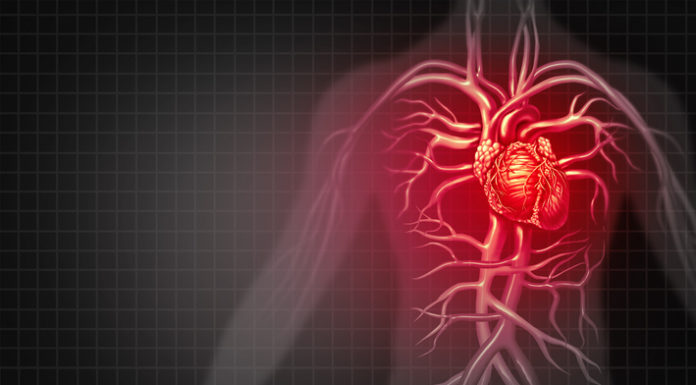 La CE aprueba Forxiga para pacientes con insuficiencia cardiaca