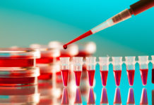 La I+D, crucial en el abordaje del VIH aunque todavía con un largo camino que recorrer
