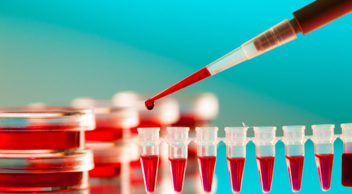 La I+D, crucial en el abordaje del VIH aunque todavía con un largo camino que recorrer