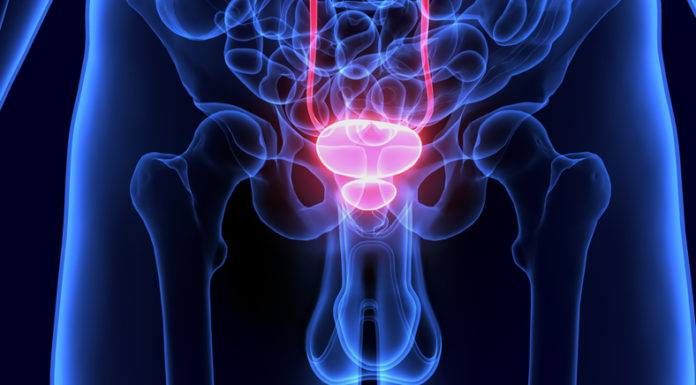 La CE aprueba Bavencio para el tratamiento de mantenimiento de carcinoma urotelial