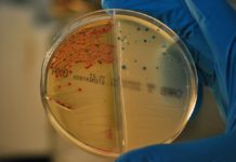 Identifican nueva estrategia para frenar las resistencias a antibióticos