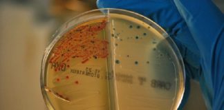 Identifican nueva estrategia para frenar las resistencias a antibióticos
