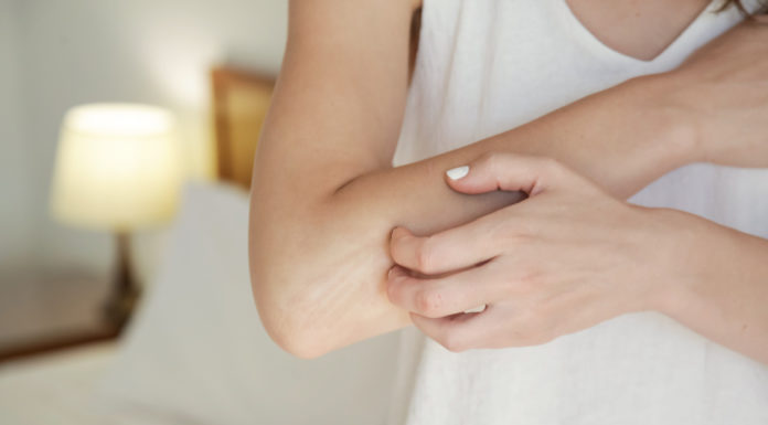 La psoriasis tiene otra consecuencia ‘invisible’: las comorbilidades psoriasis