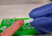 El CSIC desarrolla un test de anticuerpos ultrasensible basado en la proteína ‘spike’ de la COVID-19