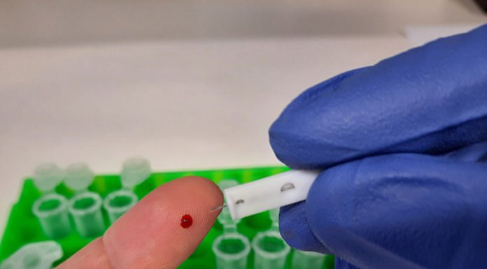 El CSIC desarrolla un test de anticuerpos ultrasensible basado en la proteína ‘spike’ de la COVID-19